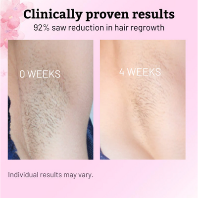 Roottide Cyperus Rotundus Oil