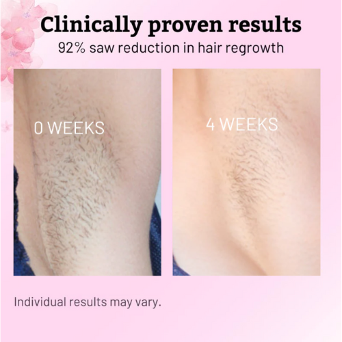 Roottide Cyperus Rotundus Oil