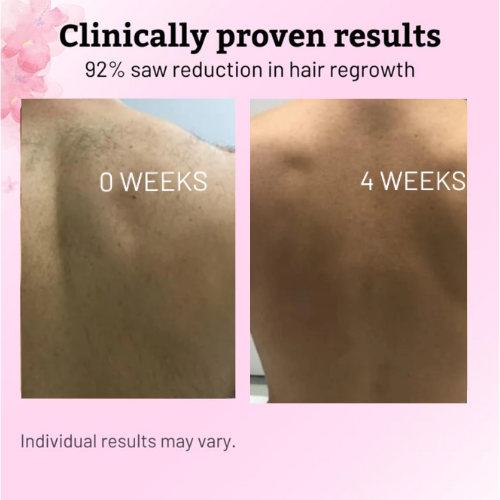 Roottide Cyperus Rotundus Oil