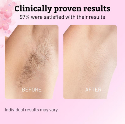 Roottide Cyperus Rotundus Oil