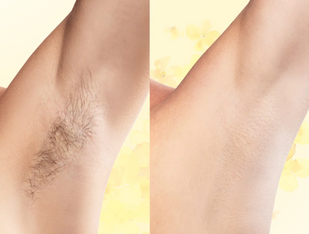 Step 3 — Exfoliate Weekly